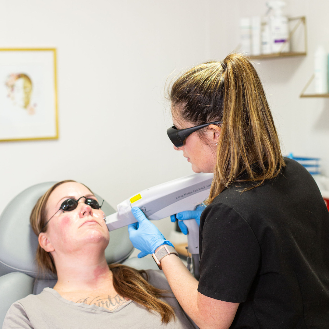 How IPL Laser Treatment Can Improve Your Skin - Pur Aesthetics and Wellness