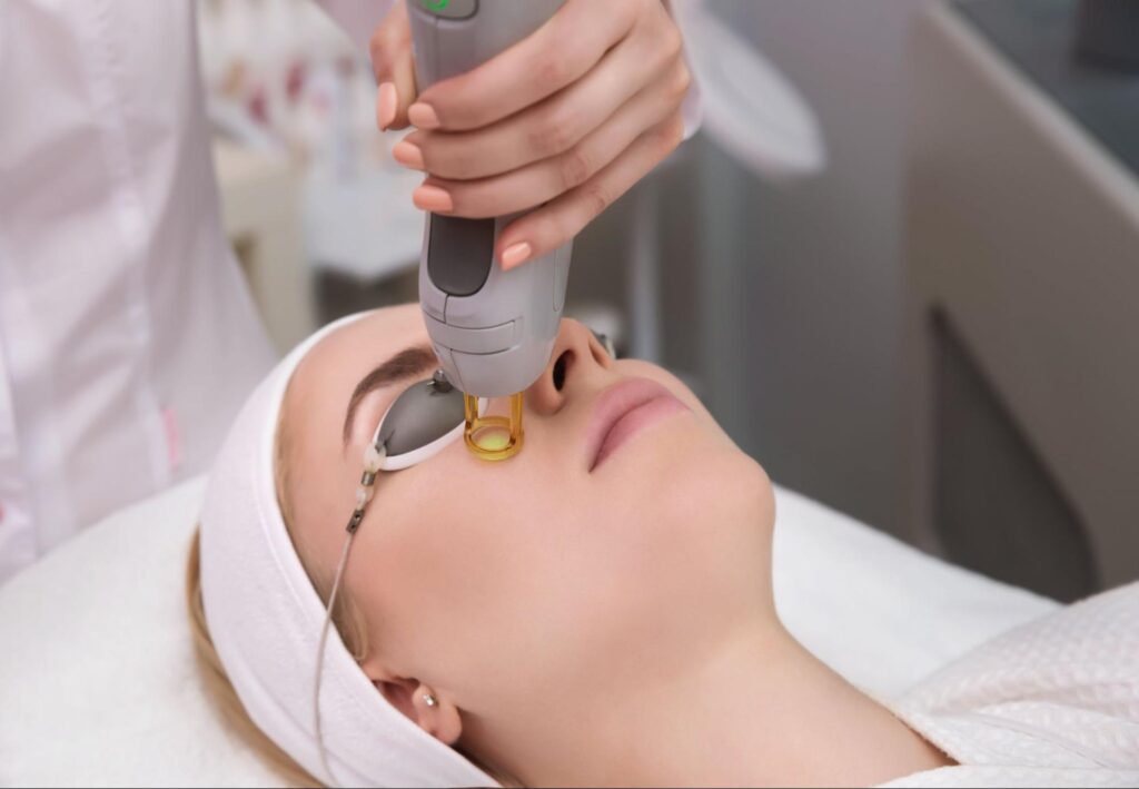 A professional performing a laser skin treatment on a client's face for skin rejuvenation.