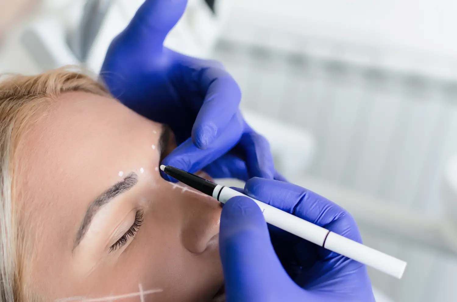 Practitioner wearing blue gloves uses a white marker to draw lines on a person’s cheek and face.