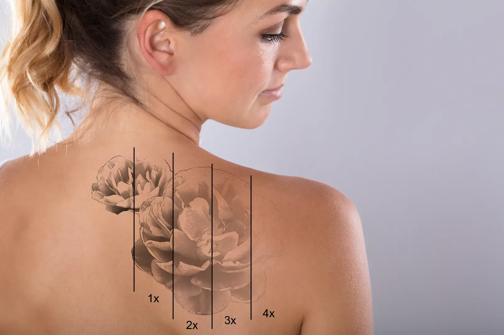 Woman's upper back with a floral tattoo divided by vertical lines labeled 1x, 2x, 3x, and 4x.