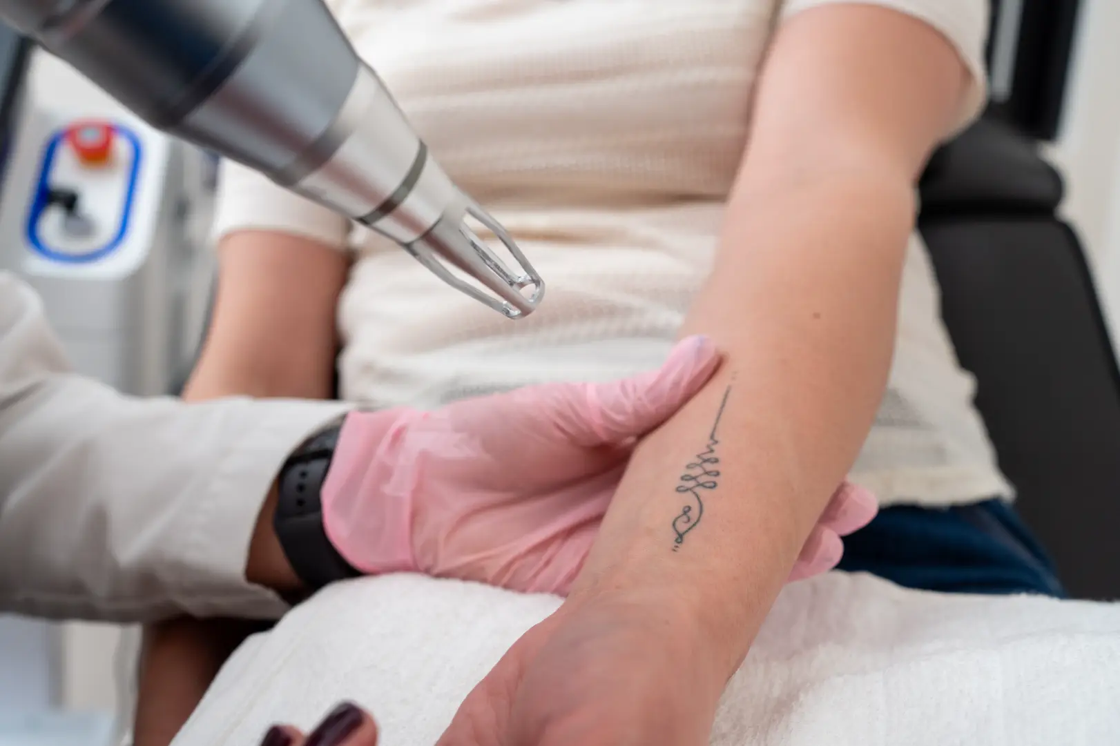 Laser device positioned above a small black tattoo on a person's forearm while a gloved hand supports the arm.